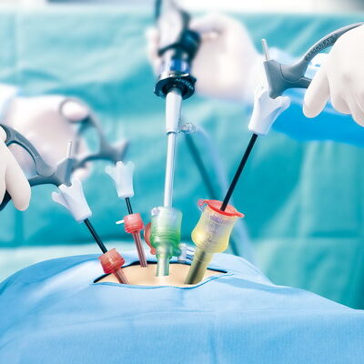 Laparoscopic Surgery