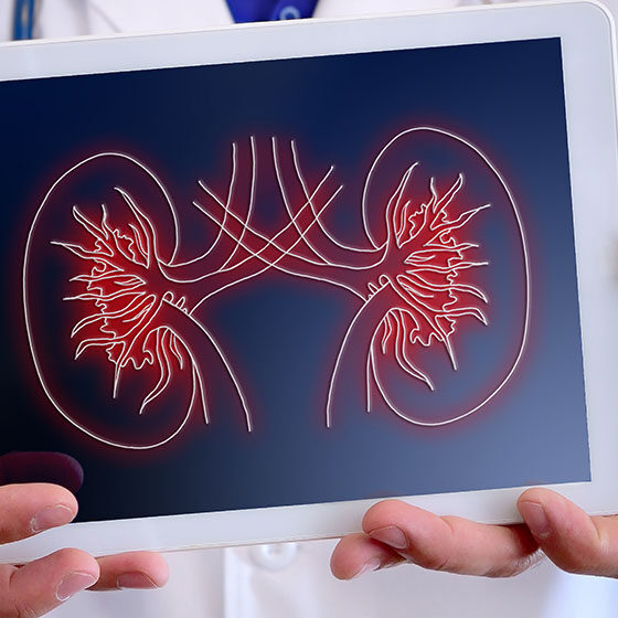 Kidney cancer