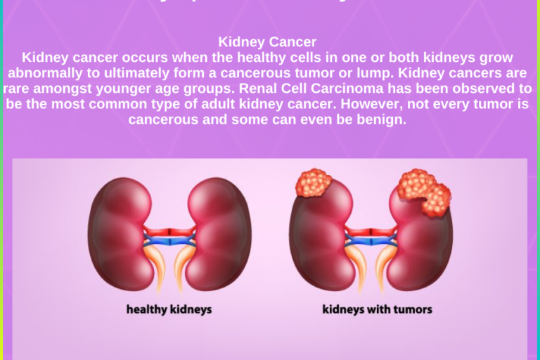 Kidney Cancer Care by Dr. Pawan Rahangdale in Pune"