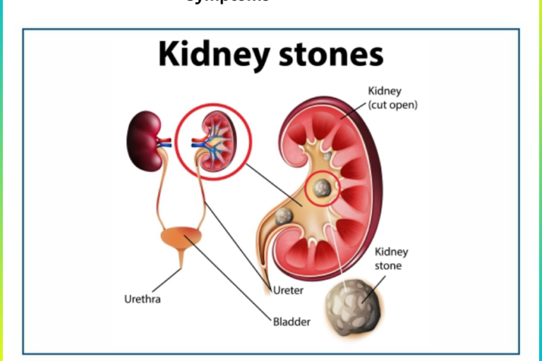 Kindney Stones Treatment in Pune