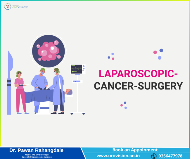 Laparoscopic Cancer Surgery in pune