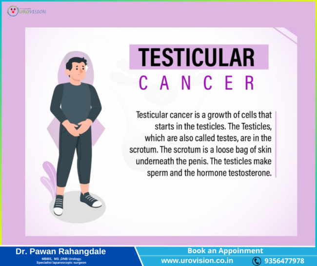Testicular Cancer Signs and symptoms, Diagnosis and  Treatment Testicular Cancer