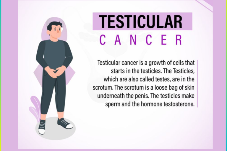 Testicular Cancer