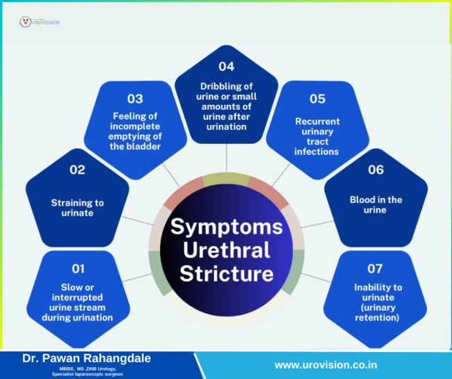 Urethral Stricture : Causes, Symptoms And Treatment Options