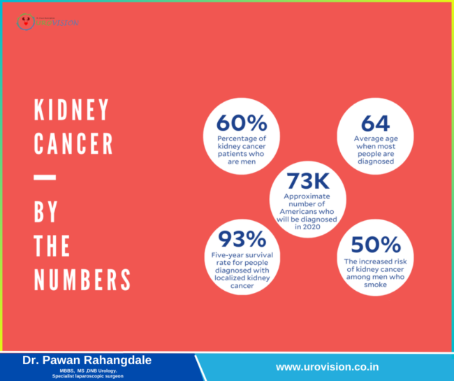 Kidney Cancer: Everything You Need to Know Kidney Cancer