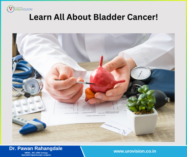 Learn all about bladder cancer! bladder cancer