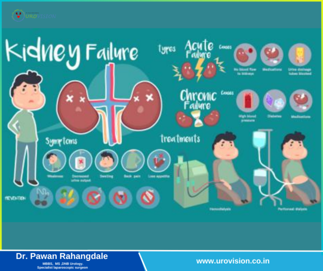 Facts you need to know about Kidney Cancer Kidney Cancer