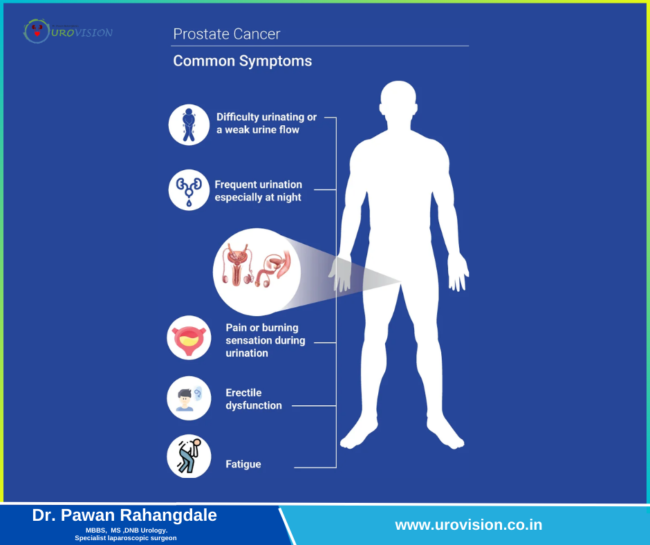 Prostate Cancer: Causes, Symptoms, and Treatment Options for Better Outcomes Prostate Cancer treatment in pune