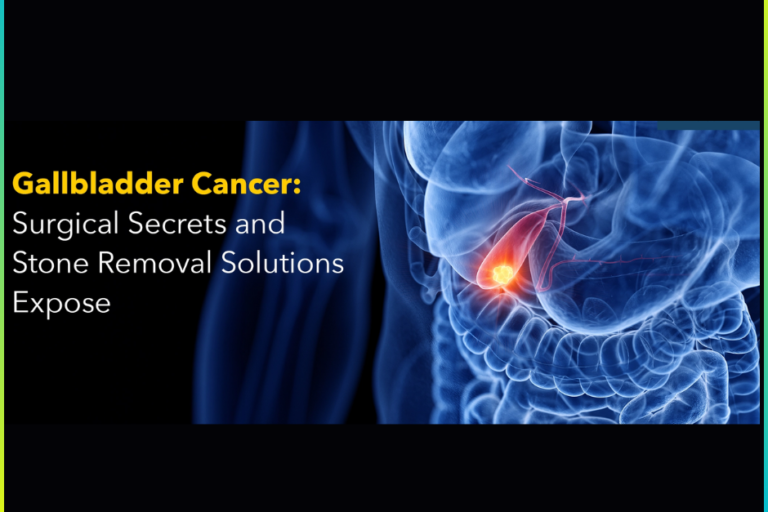 Gallbladder Tractment in Pune