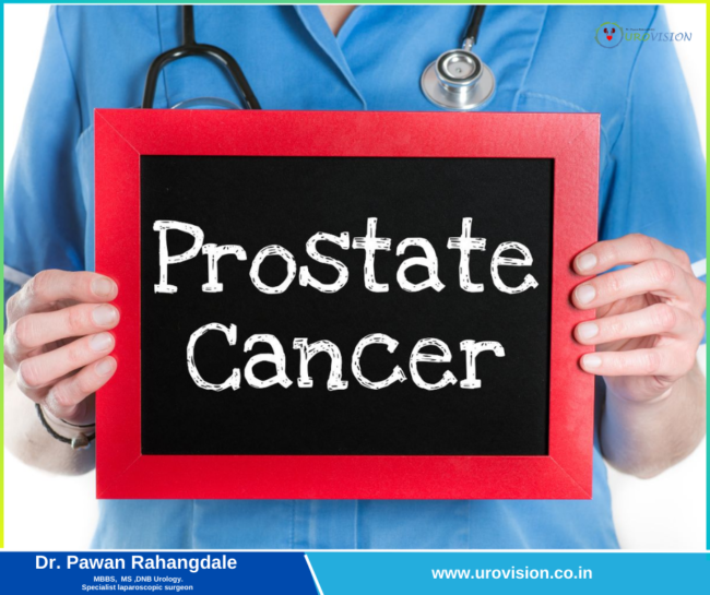 Understanding Prostate Cancer: Symptoms, Diagnosis, and Treatment Prostate Cancer Treatment in Pune