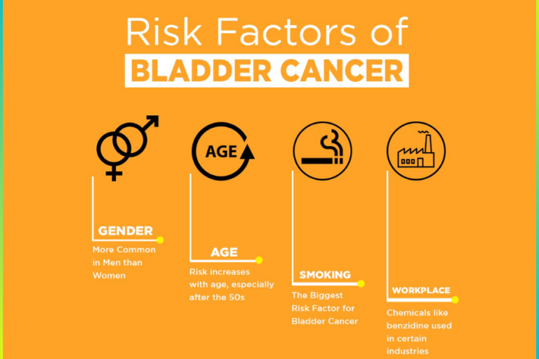 Risk Factors of Bladder Cancer By Dr. Pawan Rahangdale, Urovision Urology Care Clinic Bladder Cancer Treatment in Pune