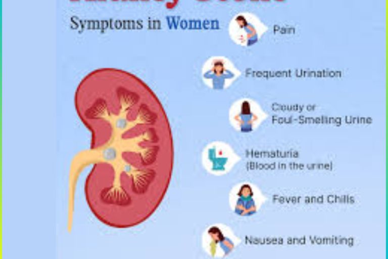 Kidney Stones: Symptoms in Men and Women Kidney Stones Treatment in Pune