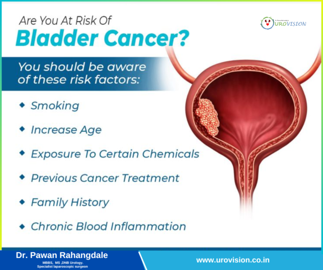 Are You at Risk of Bladder Cancer? Bladder Cancer Treatment in pune