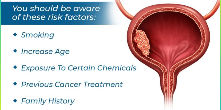 Bladder Cancer Treatment in pune