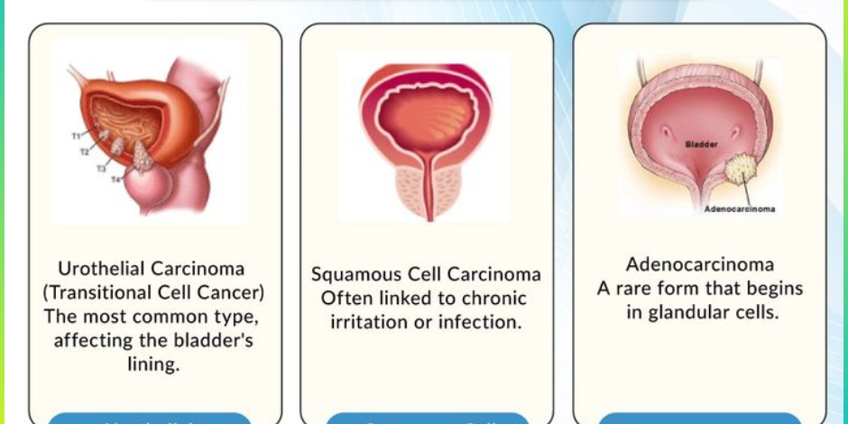 bladder cancer specialist in Pune