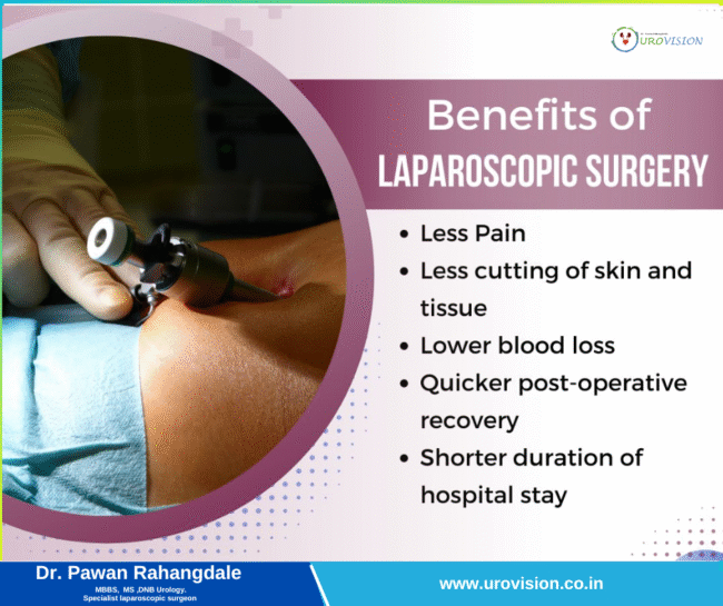 Benefits of Laparoscopic Surgery Laparoscopic Surgery in pune
