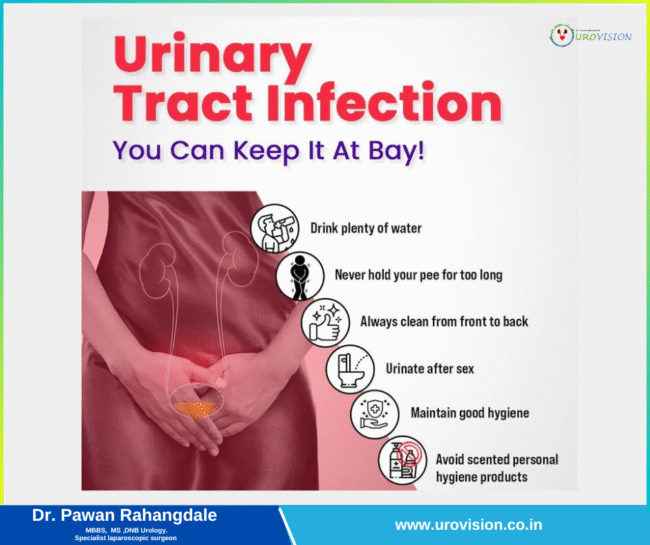 Urinary Tract Infection: You Can Keep It at Bay Urinary Tract Infection