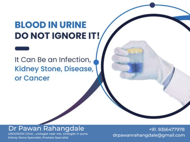 Gliding Star GMB (9) urologist in pune