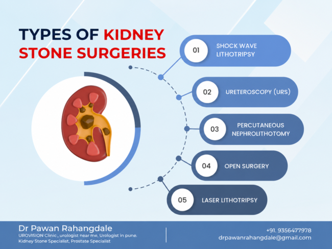 kidney stone treatment in pune