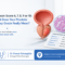 Explanation From a Prostate Cancer Specialist in Pune