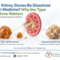 Medical illustration showing kidney stones and medicines used to treat certain types of kidney stones.